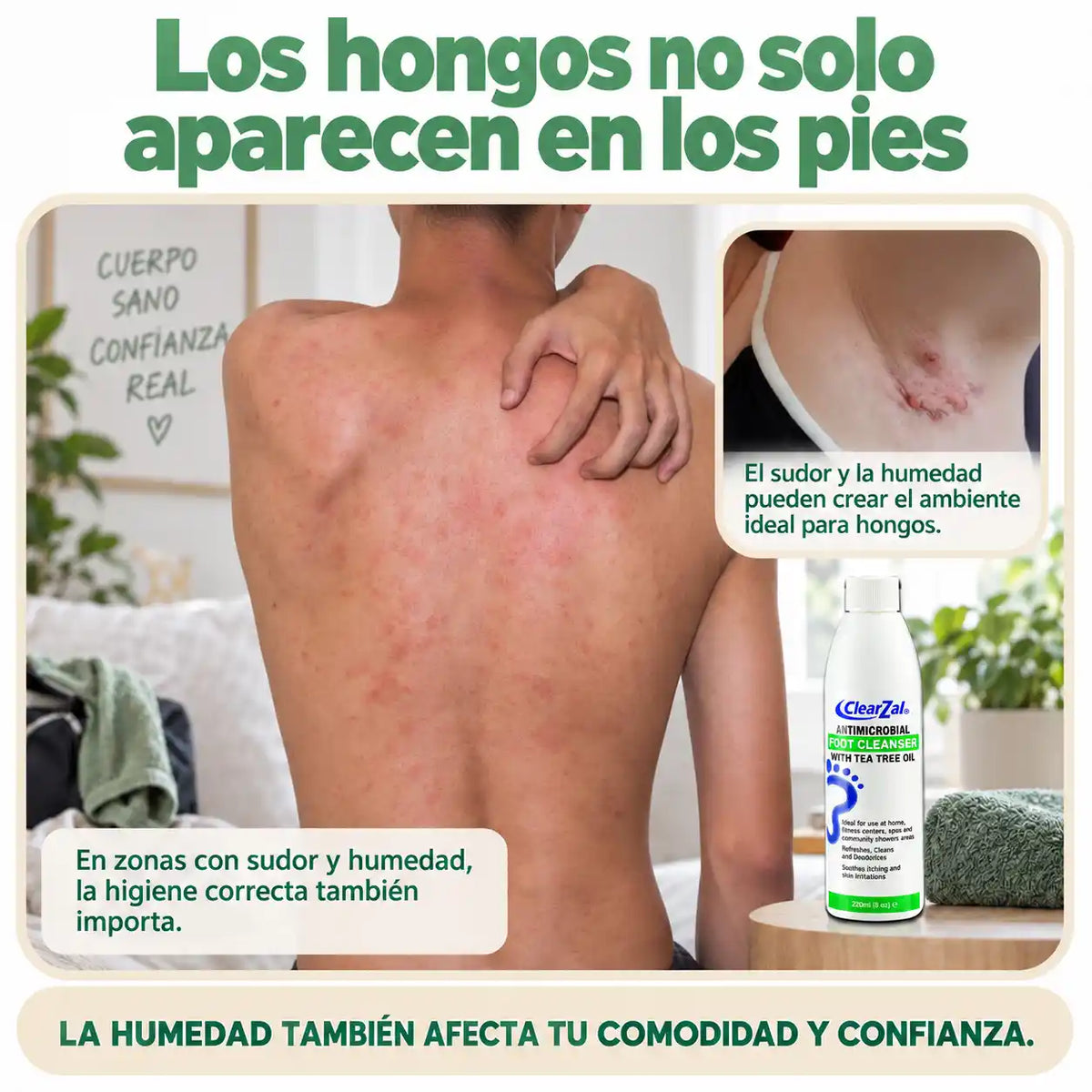 Jabón Anti hongos NATURDERM™