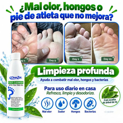 Jabón Anti hongos NATURDERM™